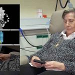 Moždani implantati slijepoj ženi omogućili da vidi jednostavne oblike